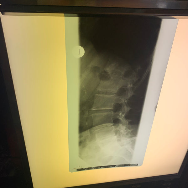 Röntgenbildbetrachter